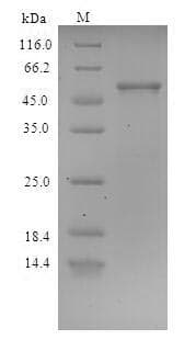 Staphylococcus aureus clfA Protein (Recombinant 6His-SUMO, N-terminus)