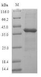 Staphylococcus aureus mecA Protein (Recombinant 6His-SUMO, N-terminus)
