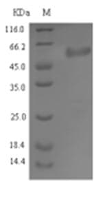 Staphylococcus aureus sdrE Protein (Recombinant 6His, N-terminus)