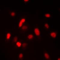 FANCM Antibody