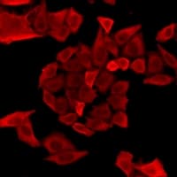 Polyclonal Rabbit anti-Human LCP1 / L-Plastin Antibody (IF, WB)