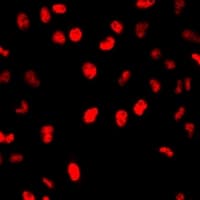 Polyclonal Rabbit anti-Human MCM7 Antibody (IF, WB)