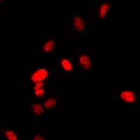 Polyclonal Rabbit anti-Human PAX6 Antibody (IF, WB)