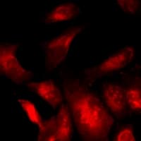 Polyclonal Rabbit anti-Human PPP1CA / PP1-Alpha Antibody (IF, WB)
