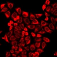 Polyclonal Rabbit anti-Human REG3G Antibody (IF, WB)