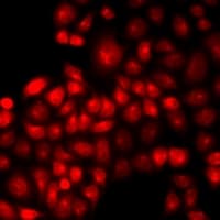 Polyclonal Rabbit anti-Human IRF2 Antibody (IHC, IF, WB)