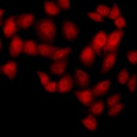 Polyclonal Rabbit anti-Human NUDT6 Antibody (IHC, IF, WB)