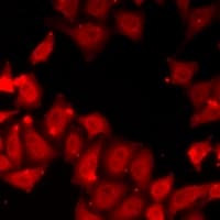 Polyclonal Rabbit anti-Human PLCB1 / Phospholipase C Beta 1 Antibody (IHC, IF, WB)