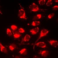 Polyclonal Rabbit anti-Human SRGN / Serglycin Antibody (IHC, IF, WB)