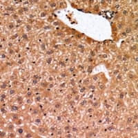 Polyclonal Rabbit anti-Human BMF Antibody (IHC, WB)