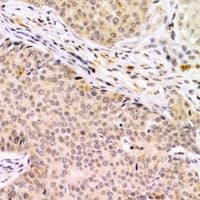 Polyclonal Rabbit anti-Human PTK6 / BRK Antibody (IHC, IF, WB)