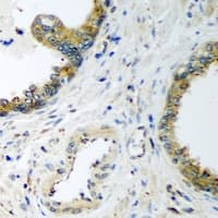 Polyclonal Rabbit anti-Human ENPEP / Aminopeptidase A Antibody (IHC, WB)