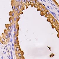 Polyclonal Rabbit anti-Human EDIL3 / DEL1 Antibody (IHC, WB)