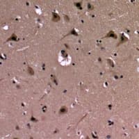 Polyclonal Rabbit anti-Human AGO2 / EIF2C2 Antibody (IHC, WB)