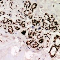 Polyclonal Rabbit anti-Human IGF2BP2 Antibody (IHC, WB)