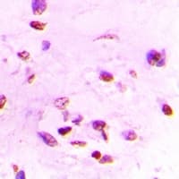 Polyclonal Rabbit anti-Human IRF2 Antibody (IHC, IF, WB)