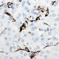 Polyclonal Rabbit anti-Human Leptin Antibody (IHC, WB)