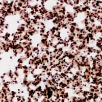 Polyclonal Rabbit anti-Human MDC1 Antibody (IHC, WB)
