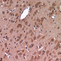 Polyclonal Rabbit anti-Human Osteoglycin / Mimecan Antibody (IHC, WB)