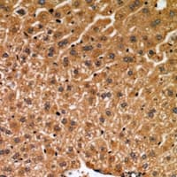 Polyclonal Rabbit anti-Human MLKL Antibody (IHC, WB)