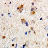 Polyclonal Rabbit anti-Human NEFH / NF-H Antibody (IHC, WB)