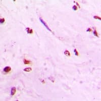 Polyclonal Rabbit anti-Human MYCN / N-myc Antibody (IHC, WB)