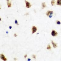 Polyclonal Rabbit anti-Human NUDT6 Antibody (IHC, IF, WB)