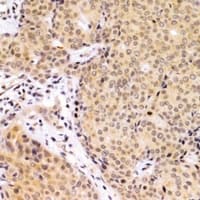 Polyclonal Rabbit anti-Human OAS1 Antibody (IHC, IF, WB)