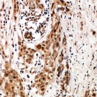 Polyclonal Rabbit anti-Human PLS3 / T Plastin Antibody (IHC, WB)