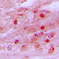 Polyclonal Rabbit anti-Human PLCB1 / Phospholipase C Beta 1 Antibody (IHC, IF, WB)