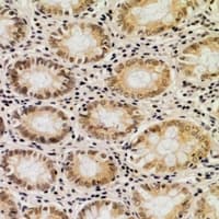 Polyclonal Rabbit anti-Human LRPAP1 Antibody (IHC, WB)