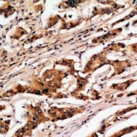 RARS2 / ARGRS Antibody