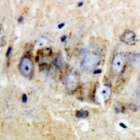 Polyclonal Rabbit anti-Human REG3A Antibody (IHC, IF, WB)