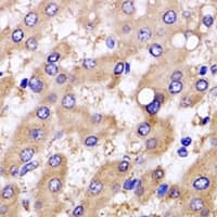 Polyclonal Rabbit anti-Human SRGN / Serglycin Antibody (IHC, IF, WB)