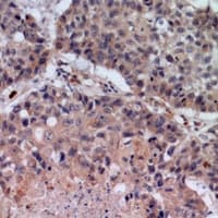 Polyclonal Rabbit anti-Human SDC2 / Syndecan 2 Antibody (IHC, WB)