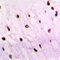 TET2 Antibody