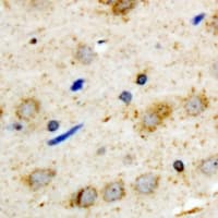 Polyclonal Rabbit anti-Human WNT3A Antibody (IHC, WB)