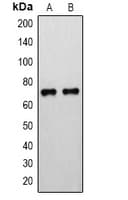 Polyclonal Rabbit anti-Human ALOX15 / 15-Lipoxygenase Antibody (IHC, WB)
