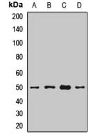 Polyclonal Rabbit anti-Human BACE1 / BACE Antibody (WB)