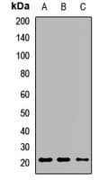Polyclonal Rabbit anti-Human BMF Antibody (IHC, WB)