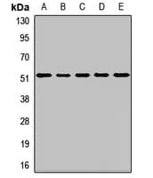 Polyclonal Rabbit anti-Human PTK6 / BRK Antibody (IHC, IF, WB)