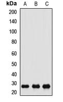 CACYBP Antibody