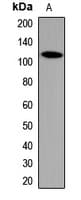 Polyclonal Rabbit anti-Human CAST / Calpastatin Antibody (WB)