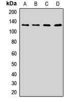 Polyclonal Rabbit anti-Human CAST / Calpastatin Antibody (WB)