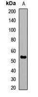 Polyclonal Rabbit anti-Human CNR1 / CB1 Antibody (WB)