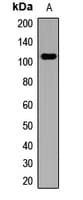 Polyclonal Rabbit anti-Human ENPEP / Aminopeptidase A Antibody (IHC, WB)