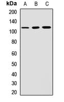 Polyclonal Rabbit anti-Human CD6 Antibody (WB)