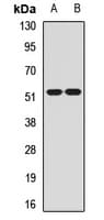 Polyclonal Rabbit anti-Human CHRM2 / M2 Antibody (IF, WB)
