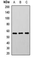 Polyclonal Rabbit anti-Human CHRNB2 Antibody (IHC, WB)