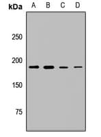 Polyclonal Rabbit anti-Human Complement C3 Antibody (IHC, WB)